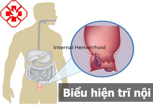 The contents of the internal trih